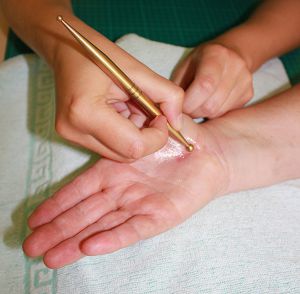 Handtherapie und Handrehabilitation